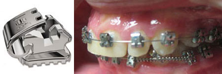  Time 2 American Orthodontics