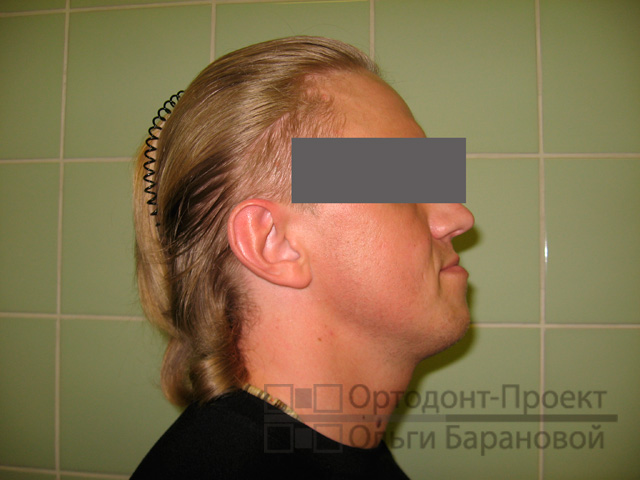 Если нижняя губа выпирает вперед Если нижняя губа выпирает вперед